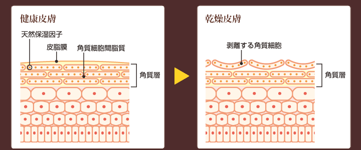 ほくろってどんな病気?