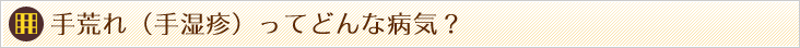 手荒れ(手湿疹)ってどんな病気?