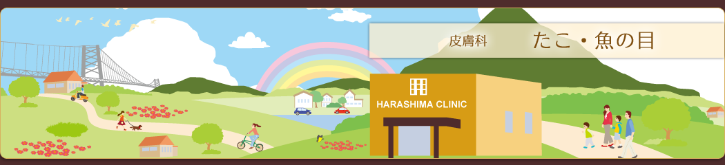 皮膚科/アレルギー科:たこ・魚の目