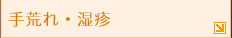 手荒れ・湿疹